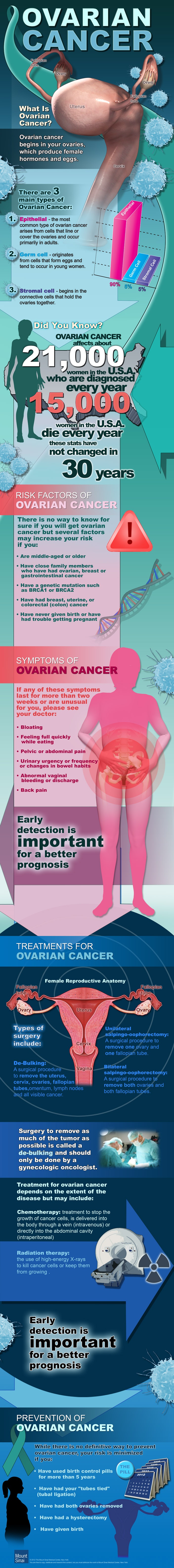 InfoGraphic on Ovarian Cancer